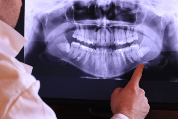Best Broken or Cracked Tooth Emergency Dentist in Barker Heights, NC
